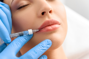 lip filler