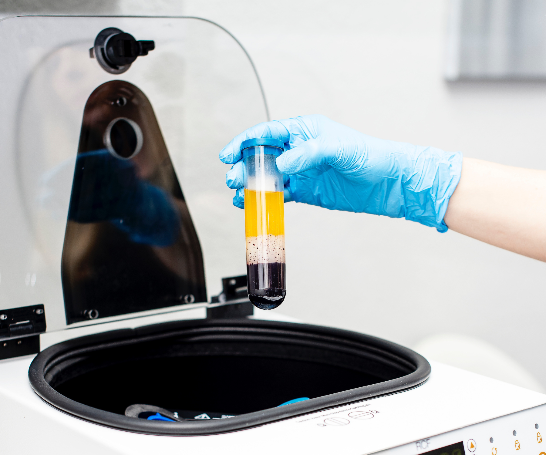 PRP in Philadelphia Ari Blanc Medical Spa Best Medical Spa Platelet Rich Plasma Therapy (2)