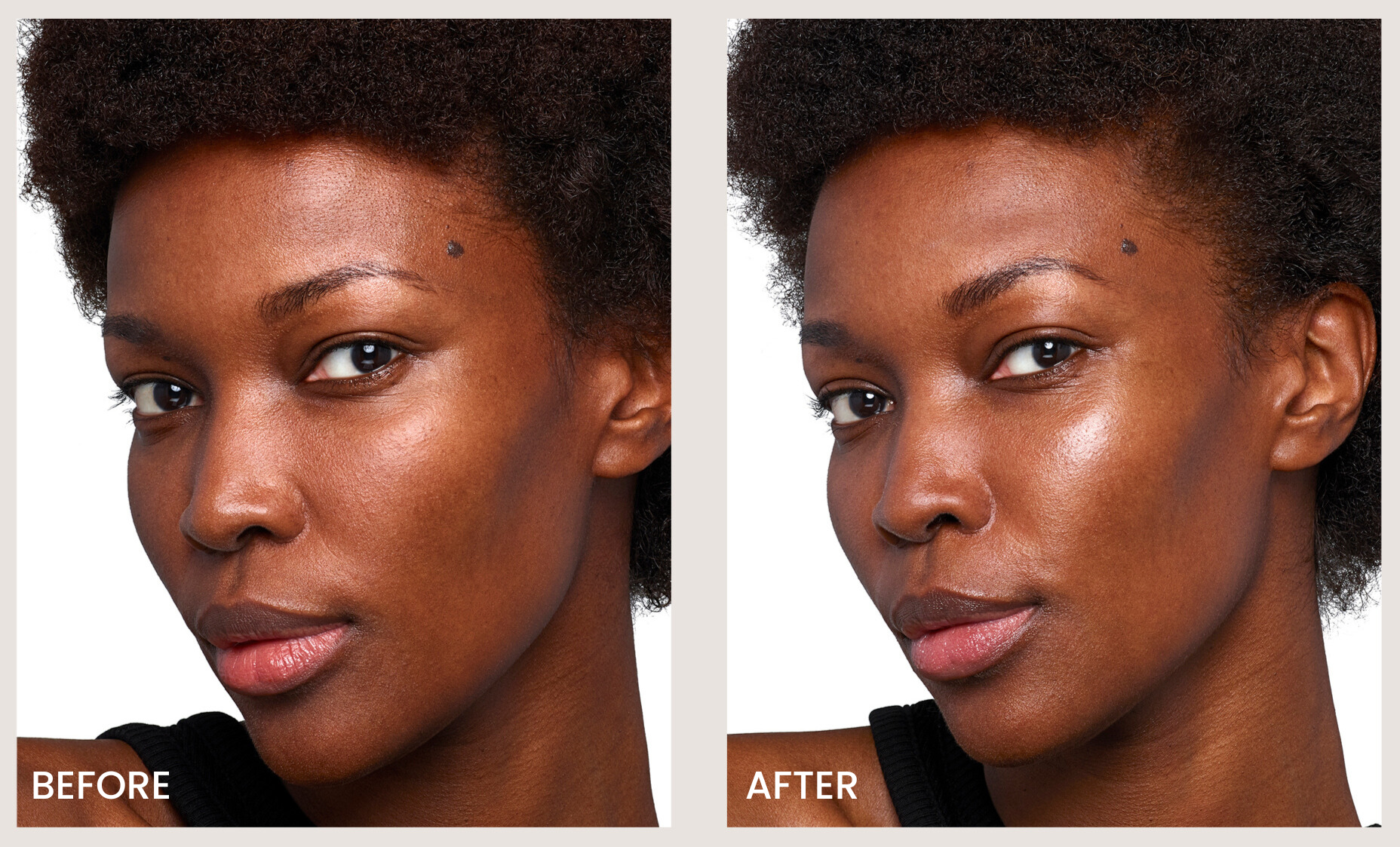 SkinVive at Ari Blanc Medical Spa in Philadelphia