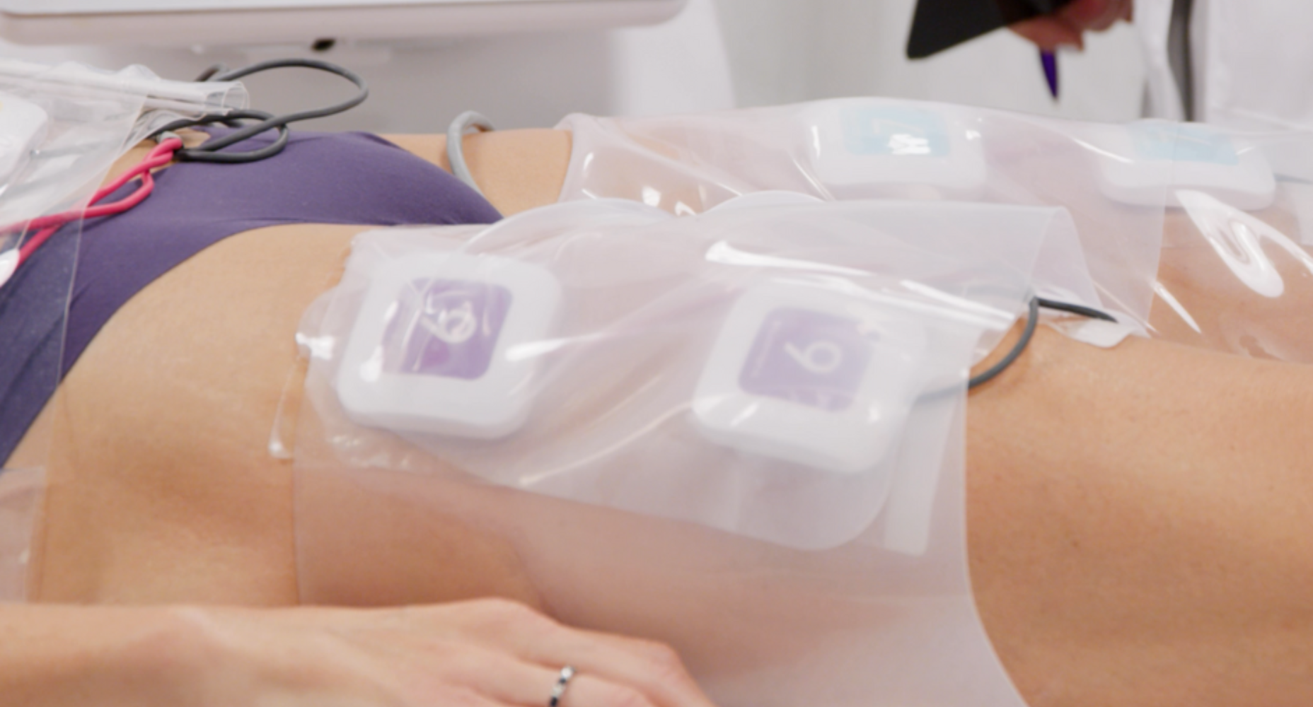 truBody Fat Reduction Muscle Sculpting in Philadelphia Ari Blanc Medical Spa