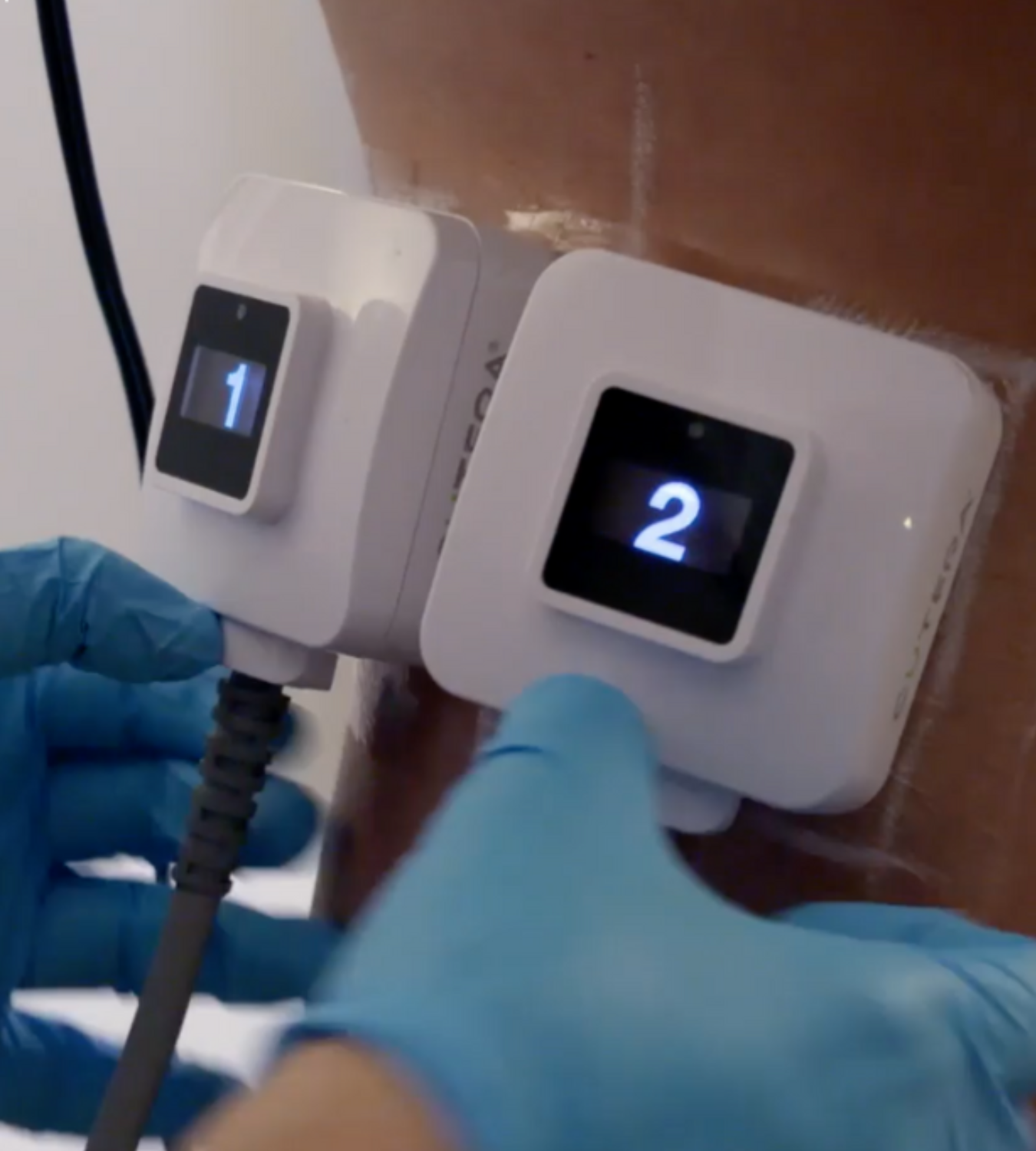 truBody Fat Reduction Muscle Sculpting in Philadelphia Ari Blanc Medical Spa (2)