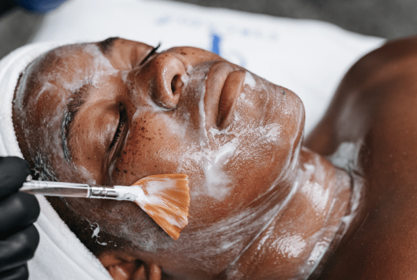 Client with congested skin receiving a creamy clarifying mask during a Clear Skin Facial to gently exfoliate, refine texture, and calm acne-prone skin.