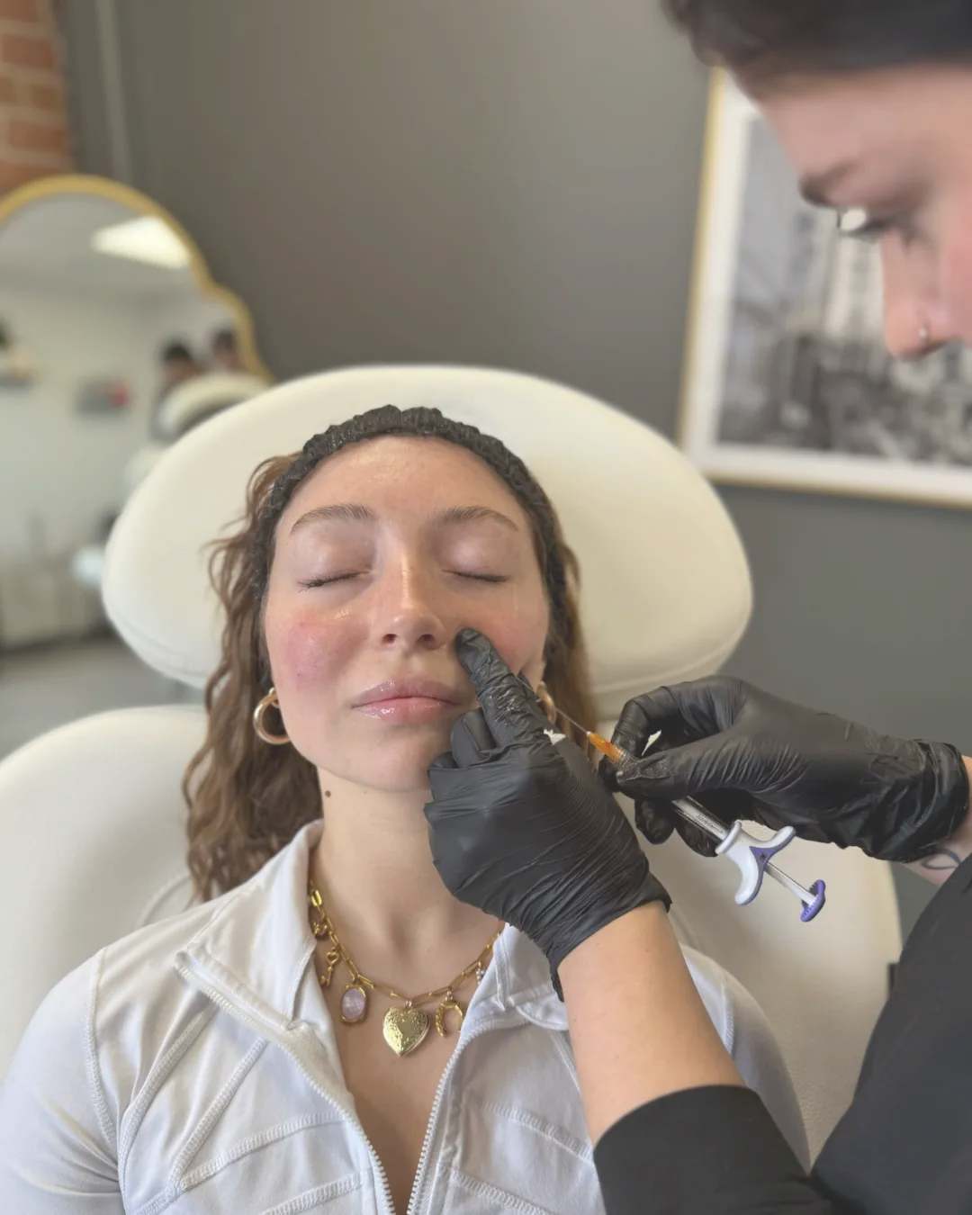 Hyaluronic Acid Fillers Philadelphia